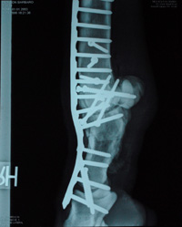 Barbaro x-ray